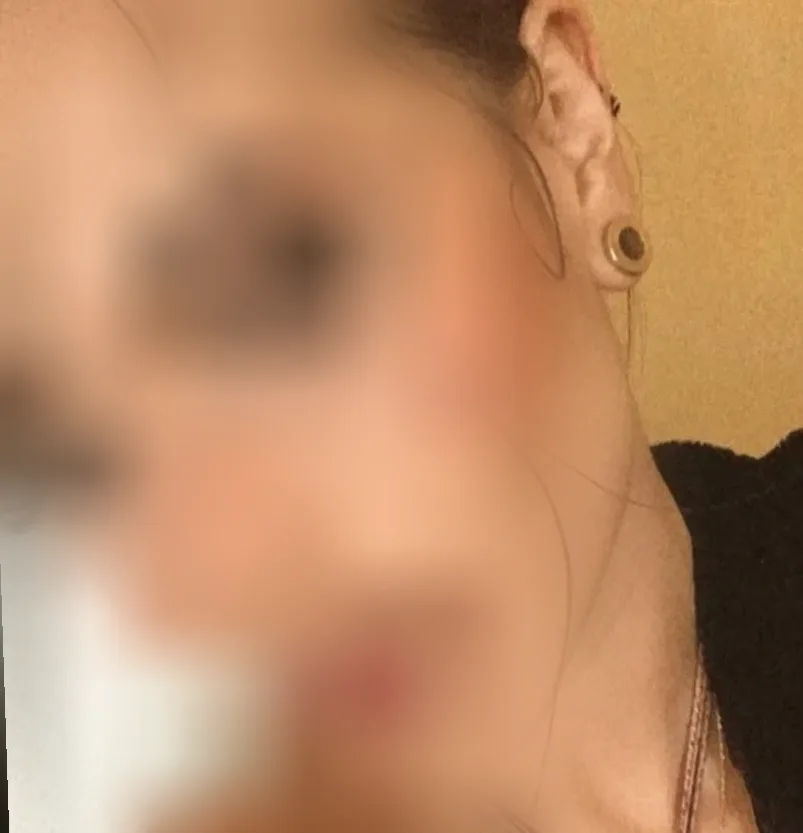 Nadja, 31